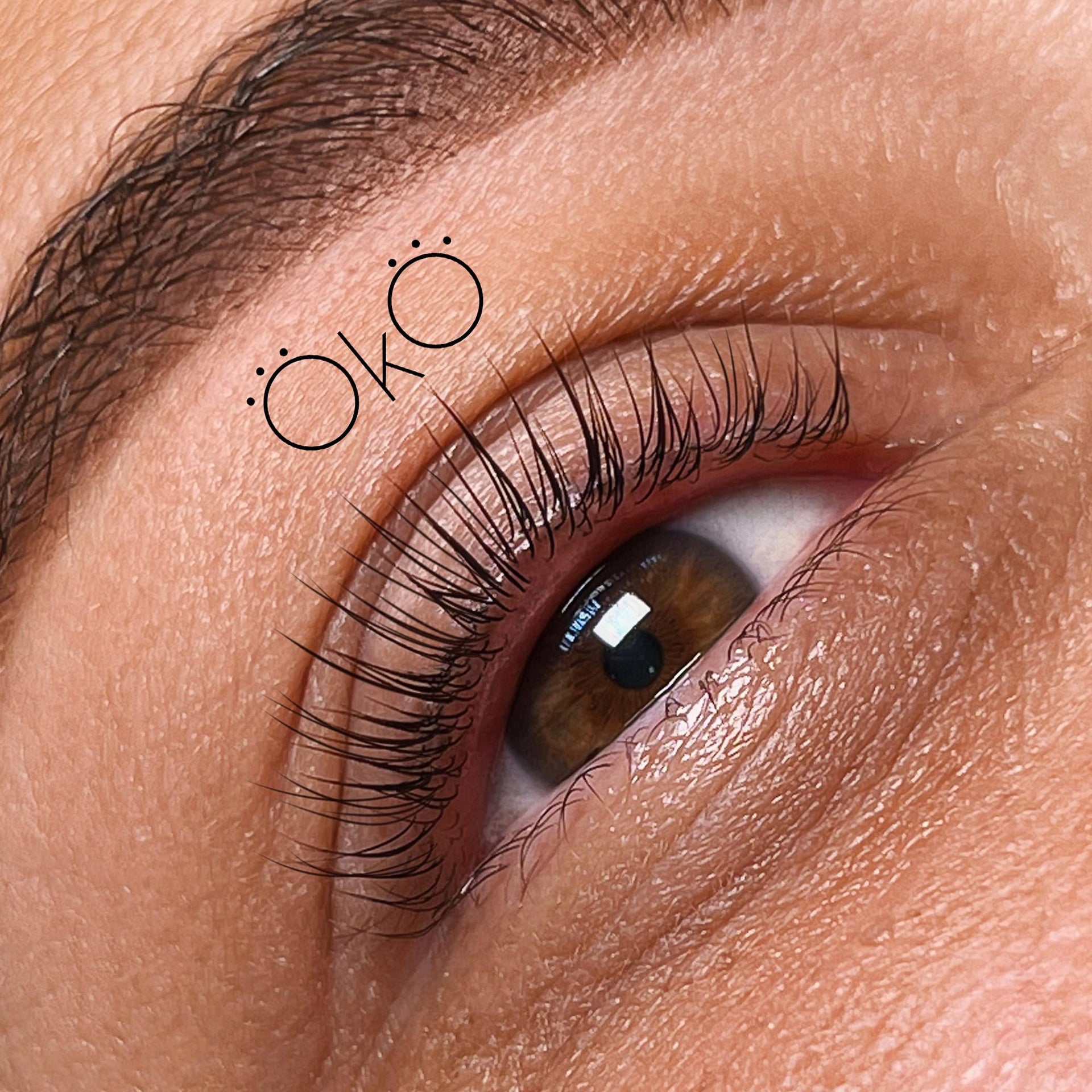 oko step 1 lift