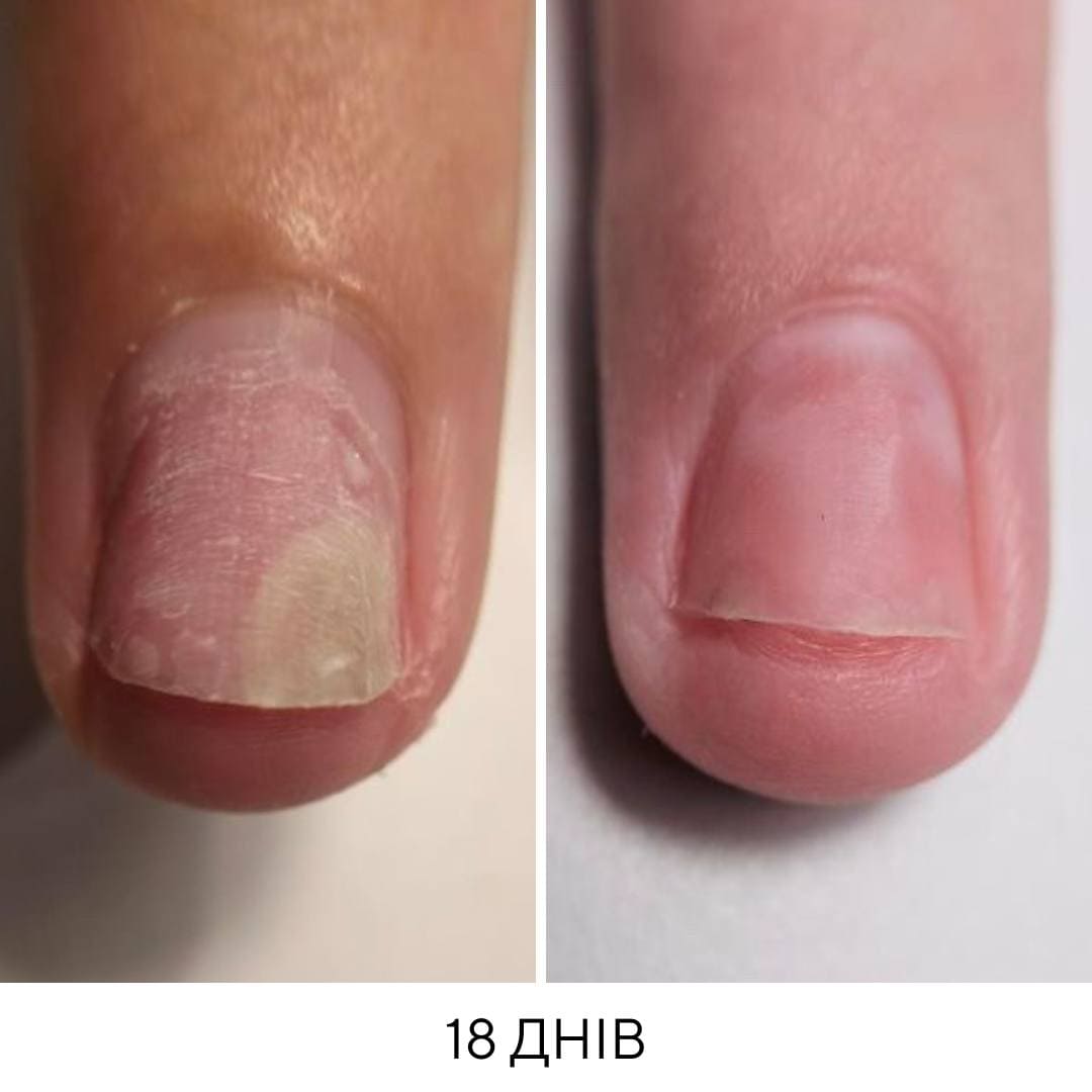 nailsoftheday onistop 8 ml