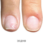Nailsoftheday ONISTOP, 15 ml